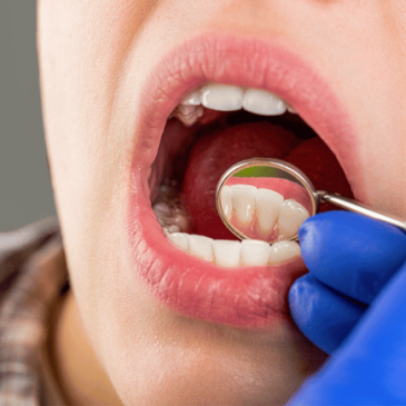 Treatment - Hatfield Dental Care
